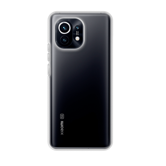 Funda para XIAOMI MI 11 personalizada movil GEL TPU con foto calidad